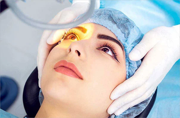 Slanting Eye Surgery