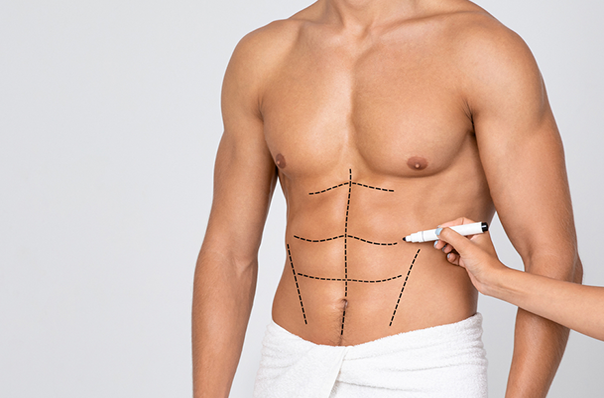 Abdominal Muscle Surgery